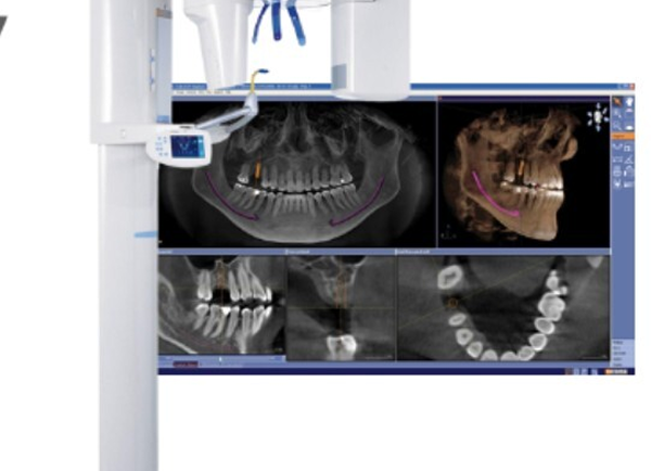 3D CBCT imaging